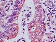 AP3D1 / Adaptin Delta Antibody (aa530-580)