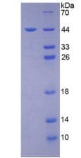 Human LPO / Lactoperoxidase Protein (Recombinant His-GST)