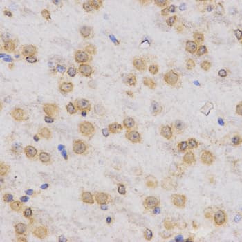 Polyclonal Rabbit anti-Human Histone H3 Antibody (Tri-Methyl-Lys36, IHC, IF, WB)
