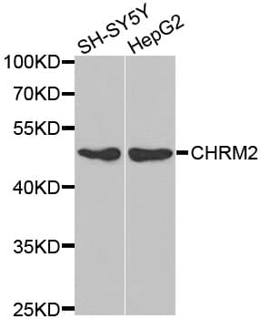 CHRM2 / M2 Antibody