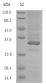 Peanut Conglutin Protein (Recombinant 6His-SUMO, N-terminus)