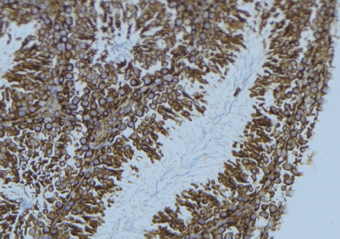 HMOX1 / HO-1 Antibody