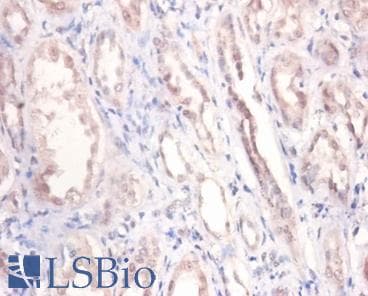 PODXL / Podocalyxin Antibody