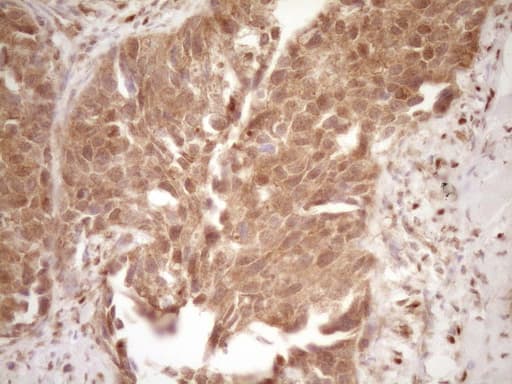 Monoclonal Mouse anti-Human GFI1 Antibody (clone OTI6E8, aa1-180, IHC, WB)