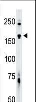 TNIK Antibody (aa1-30)