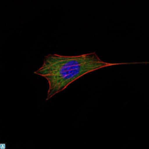 BCL2 / Bcl-2 Antibody
