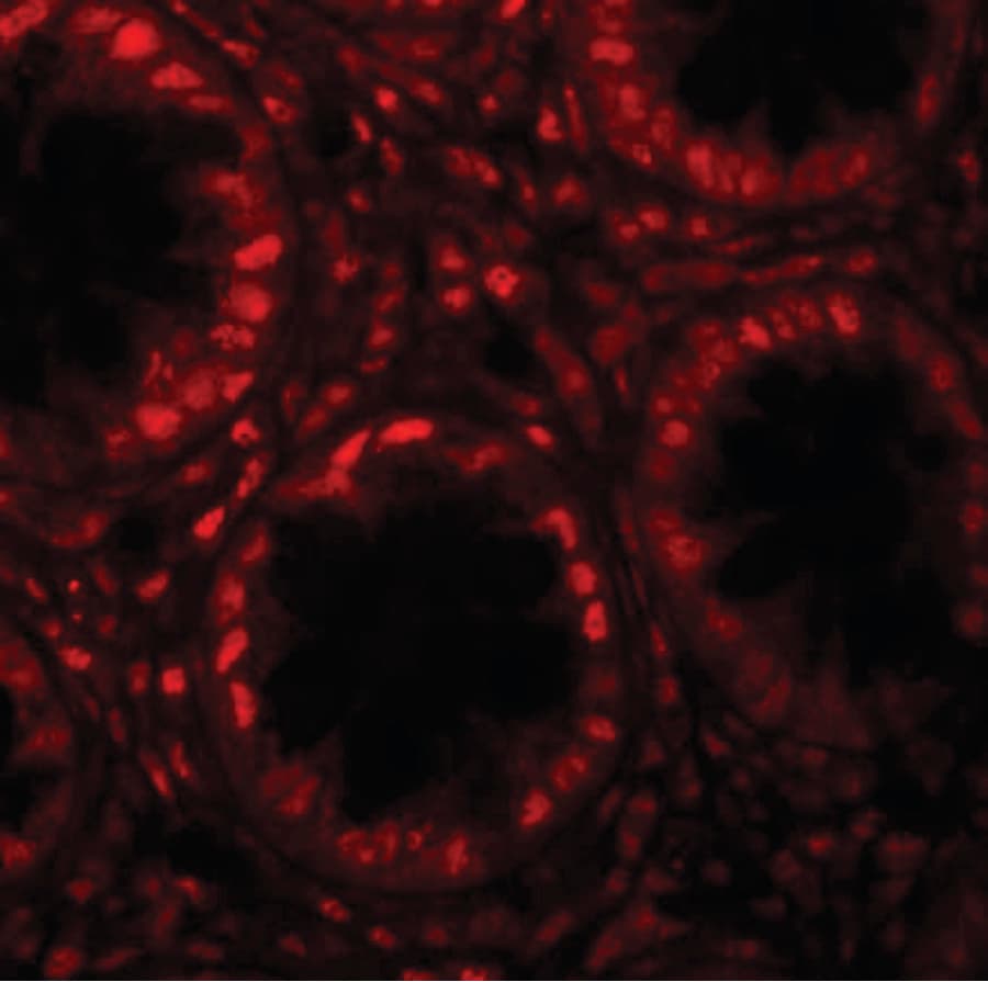 IHC-plus™ Polyclonal Rabbit anti-Human TRIP / LRRFIP1 Antibody (IHC, IF, WB)