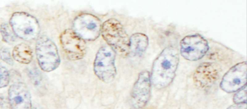 SNW1 / SKIP Antibody (aa450-500)
