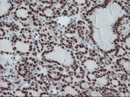 TPRKB Antibody (clone OTI3H3)