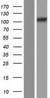 TXNDC11 Protein (Over-Expression Lysate Myc-DDK (Flag))