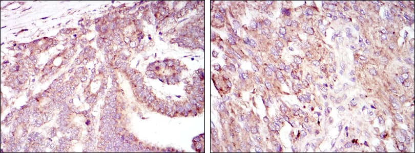 HIF1A / HIF1 Alpha Antibody (clone 1A3)