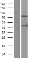 ARHGAP9 Protein (Over-Expression Lysate Myc-DDK (Flag))