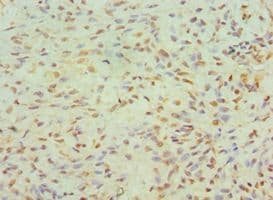 Polyclonal Rabbit anti-Human JMJD6 / PSR Antibody (aa1-320, IHC)