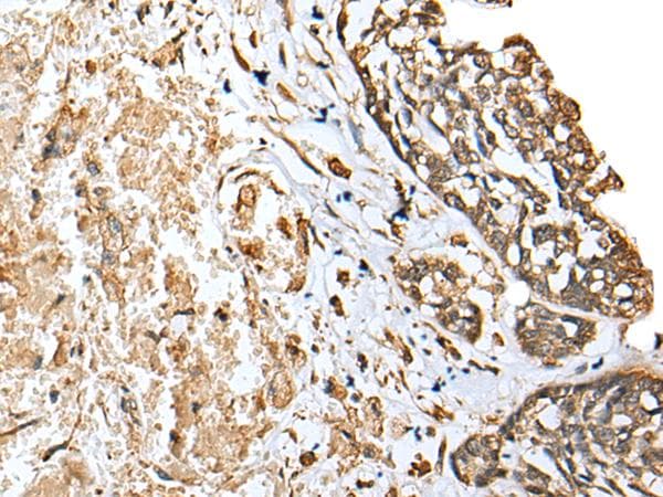 EEF1E1 / AIMP3 Antibody