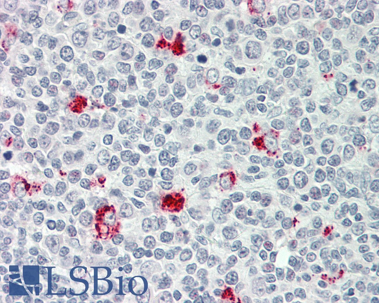 IHC-plus™ P2RY11 / P2Y11 Antibody (aa130-179)