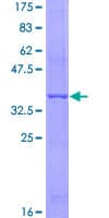 Human Adiponectin Protein (Recombinant GST, N-terminus)