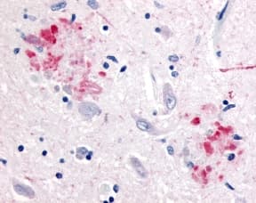 APP / Beta Amyloid Precursor Antibody