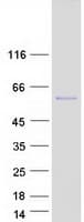 Human PRR22 Protein (Recombinant Myc-DDK (Flag))