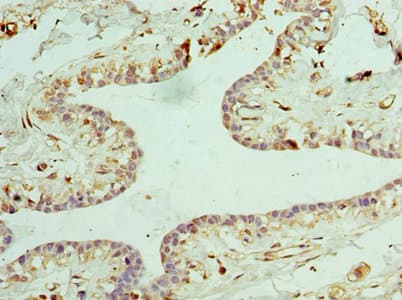 CLTA / LCA Antibody