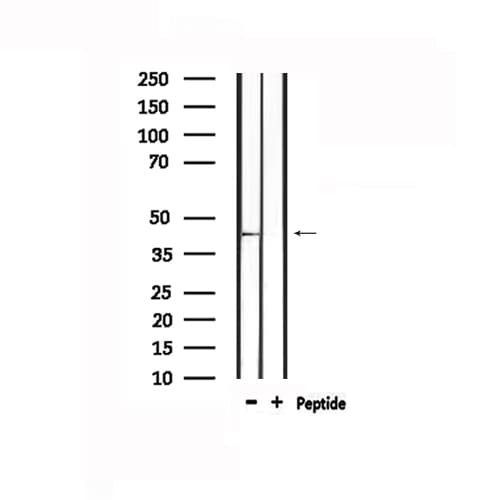 Polyclonal Rabbit anti-Human HCAR2 + HCAR3 / GPR109 Antibody (IF, WB)