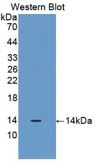 B2M / Beta 2 Microglobulin Antibody (clone A9)