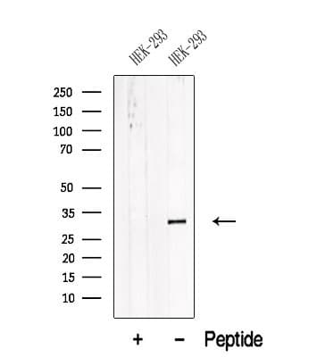 Polyclonal Rabbit anti-Human ATP6E / ATP6V1E1 Antibody (WB)