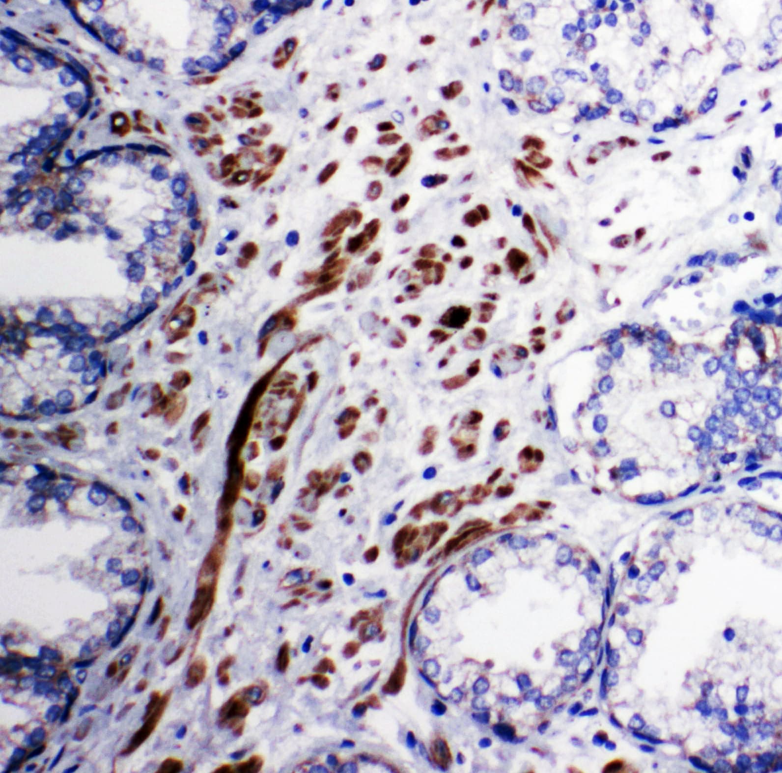 PDK1 Antibody (aa408-421)