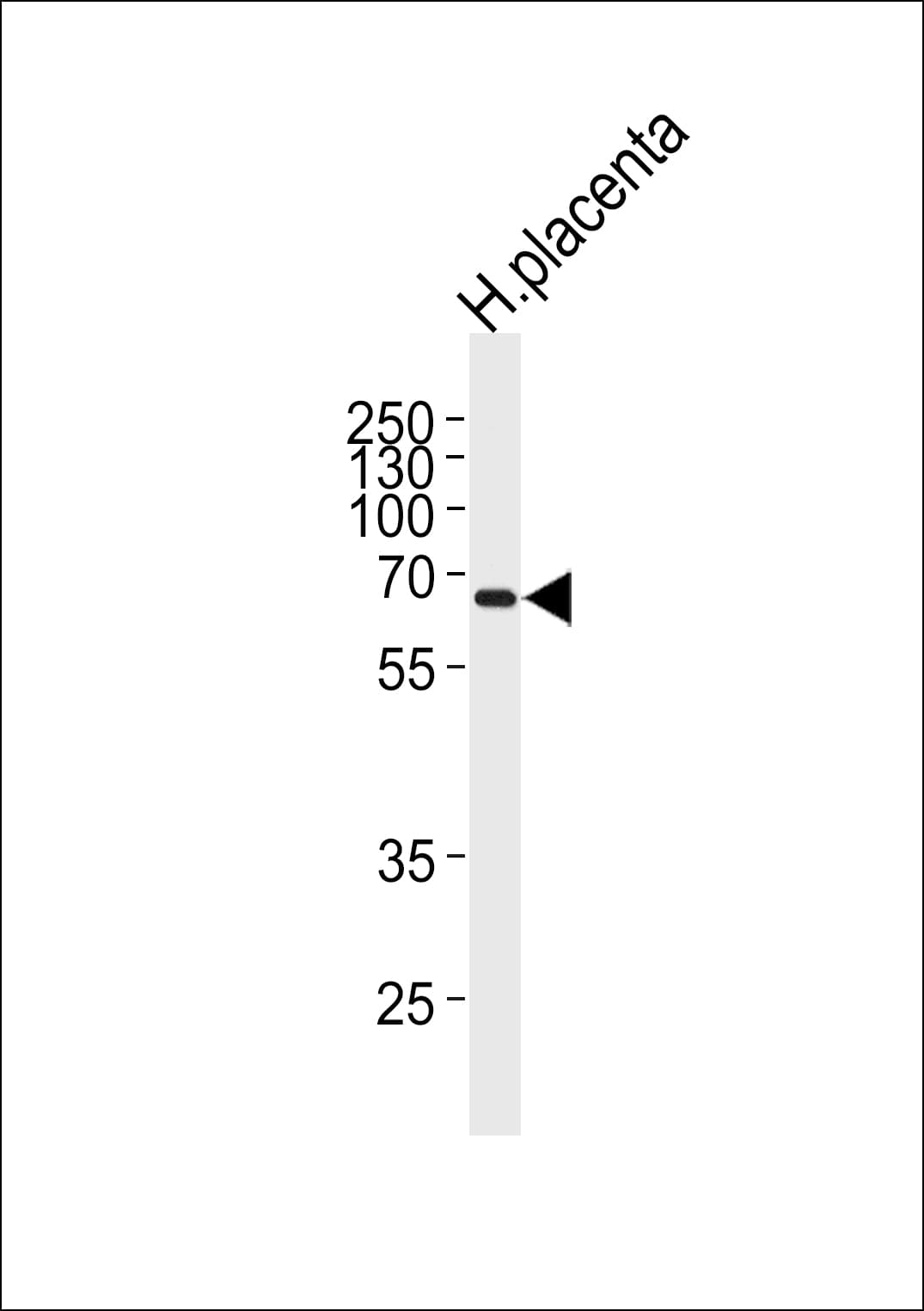 MMP19 Antibody (aa55-84)