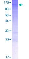 Human SYDE1 Protein (Recombinant GST)