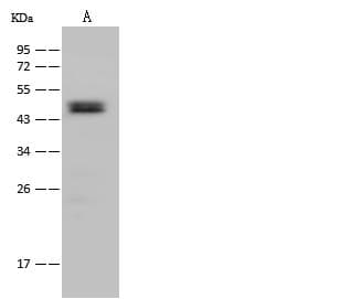 ACADSB Antibody (Preservative Free)