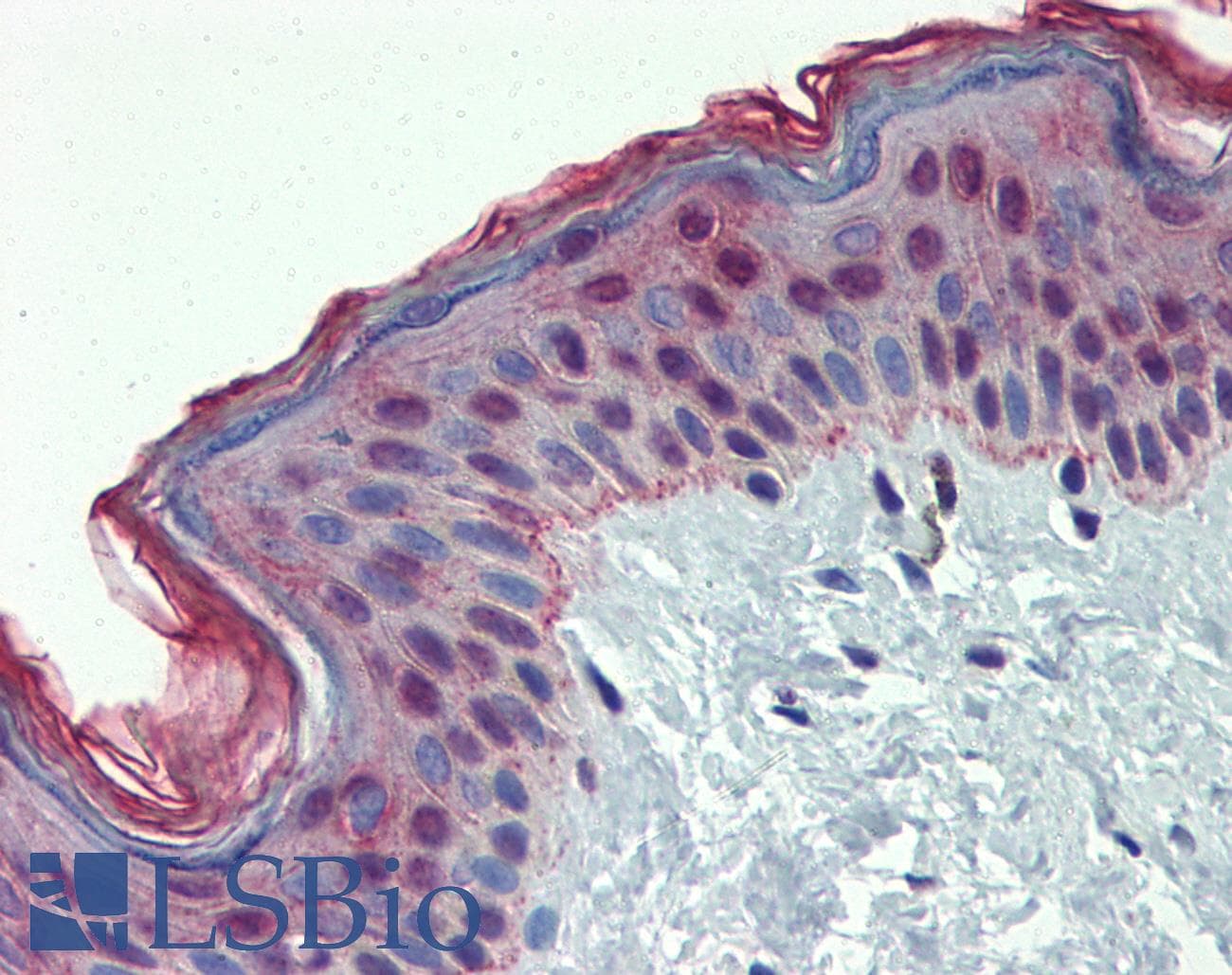 IHC-plus™ MMP3 Antibody