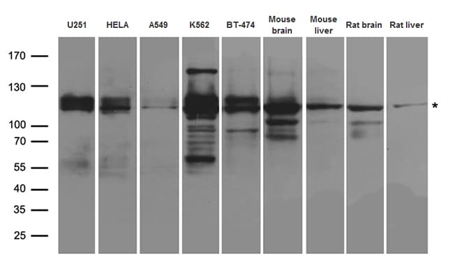 ANKRD52 Antibody
