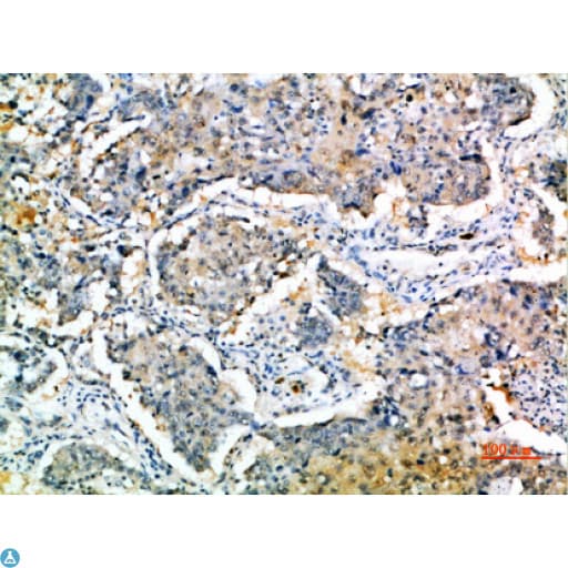 SOCS3 Antibody