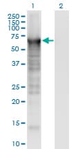 Monoclonal Mouse anti-Human PLS3 / T Plastin Antibody (clone 5B9, IF, WB)