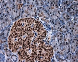 SRR / Serine Racemase Antibody (clone OTI7E8, Carrier-free)