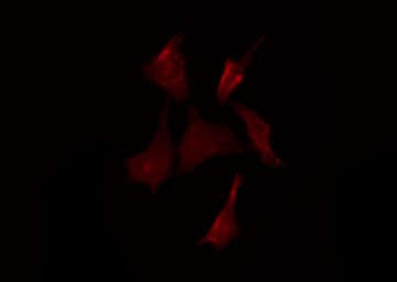 Polyclonal Rabbit anti-Human LILRA1 / LIR6 Antibody (IF, WB)