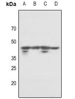 POLDIP3 / p46 Antibody