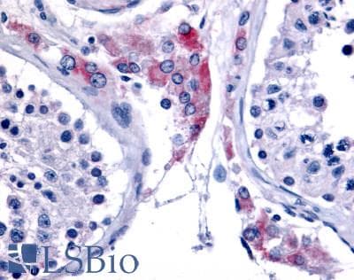 PathPlus™ ESRRB / ERR Beta Antibody (Internal)