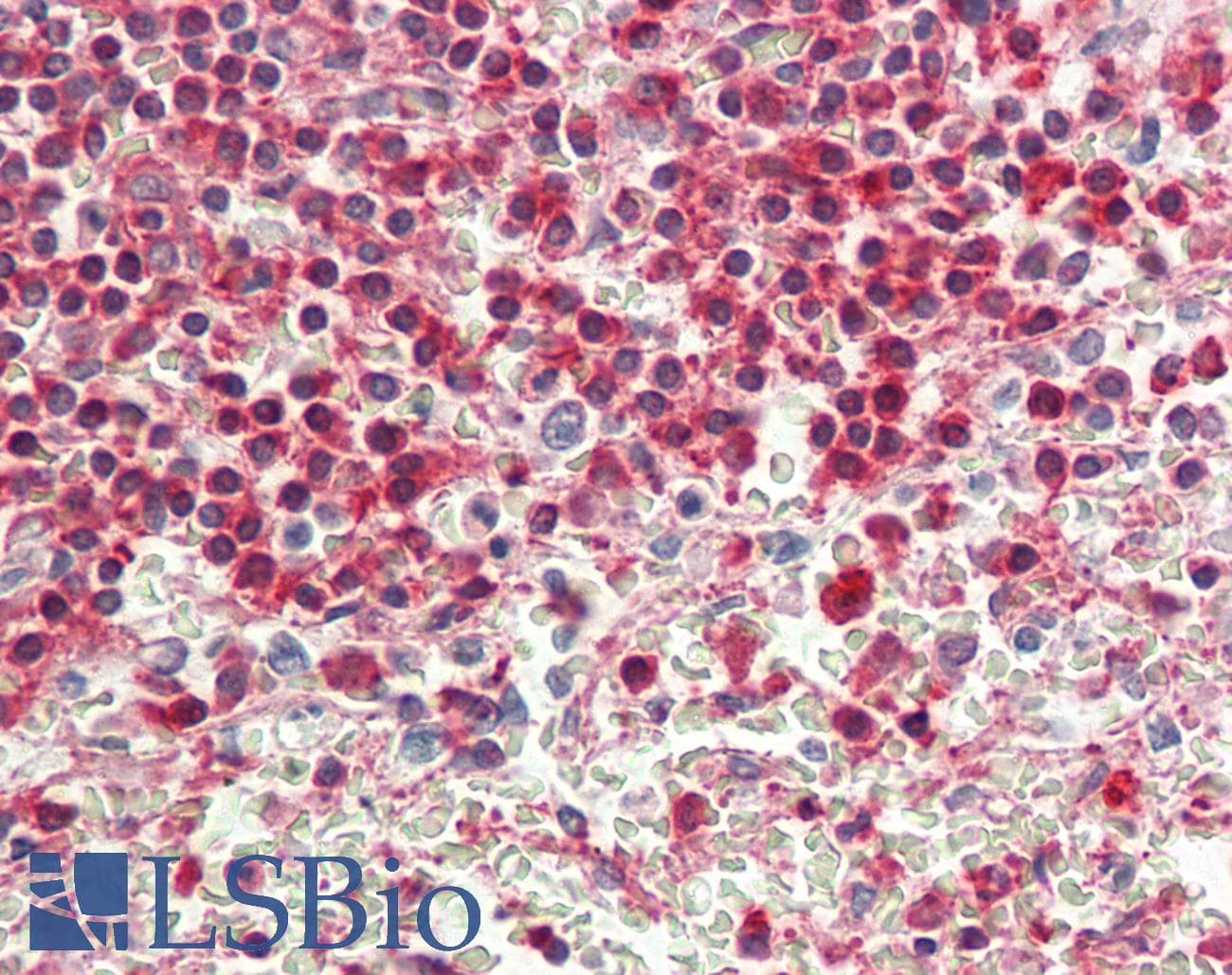 IHC-plus™ ACTG1 / Gamma Actin Antibody (aa188-215)