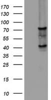 Monoclonal Mouse anti-Human OAS2 Antibody (clone OTI2A1, aa60-335, WB)