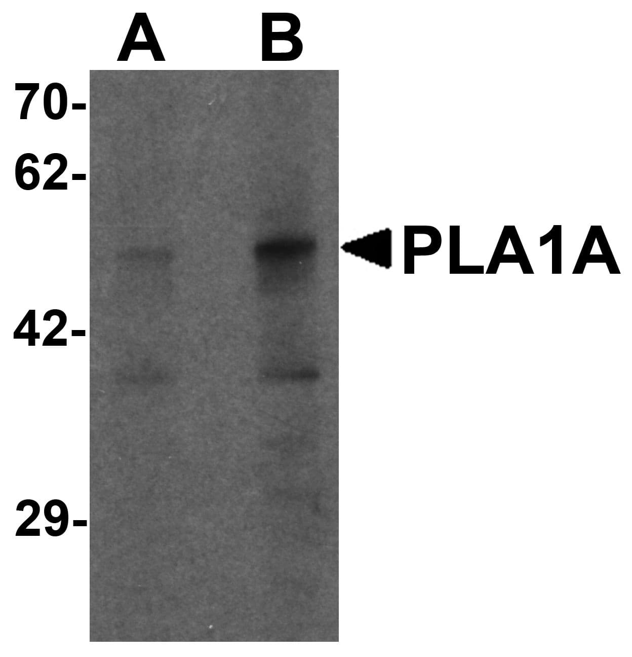 IHC-plus™ Polyclonal Rabbit anti-Human PSPLA1 / Phospholipase A1 Antibody (IHC, IF, WB)