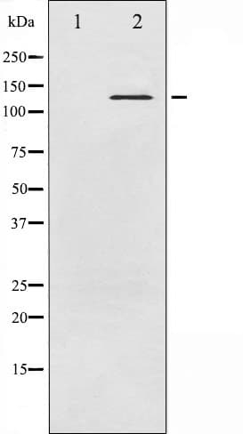 Polyclonal Rabbit anti-Human ABL1 / c-ABL Antibody (phospho-Tyr245, IF, WB)