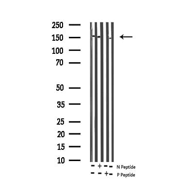 c-Met Antibody (phospho-Tyr1234)