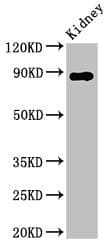 DPP4 / CD26 Antibody