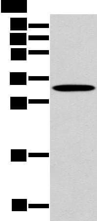 Polyclonal Rabbit anti-Human NANOS1 / NOS1 Antibody (WB)