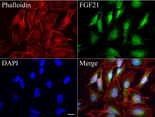 FGF21 Antibody (aa29-209, clone UMAB71, Carrier-free)
