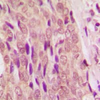 SMAD4 Antibody (N-Terminus)