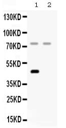 Polyclonal Rabbit anti-Human CFI / Complement Factor I Antibody (IHC, WB)