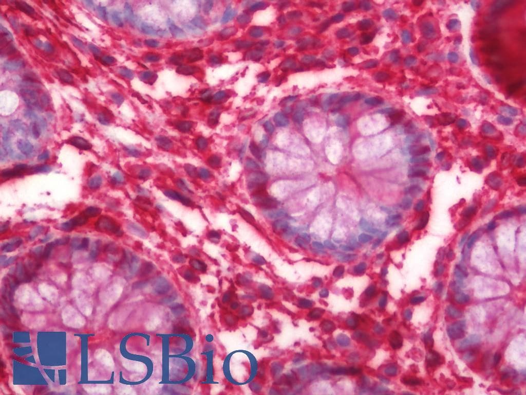 IHC-plus™ Polyclonal Rabbit anti-Human ANXA2 / Annexin A2 Antibody (aa88-137, IHC, WB)