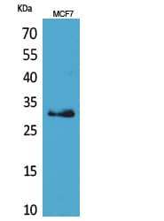 KLK1 / Kallikrein 1 Antibody
